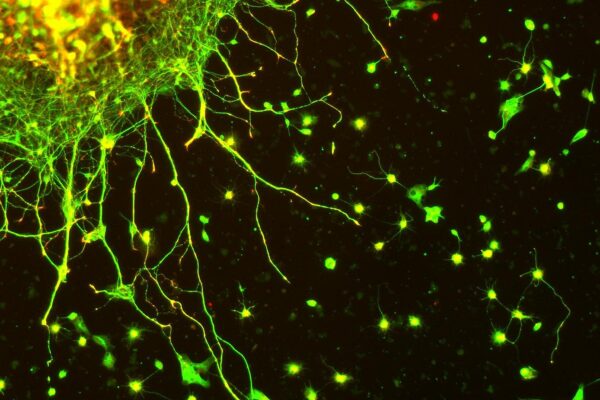 Edinger-Westphal neurons in culture and stained for Tubulin (green) and Synapsin (red). Imaged with a Zeiss Axioskop 2 FS Plus equipped with a Zeiss Axiocam HRm.